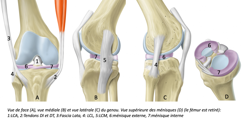 Rupture du Ligament Croisé Antérieur causes, symptômes et traitements