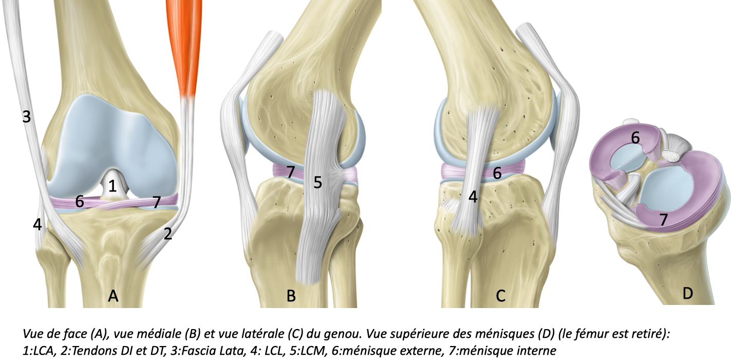 Rupture du Ligament Croisé Antérieur : causes, symptômes et ...