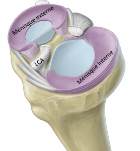 Ligament Croisé Antérieur et Ménisque